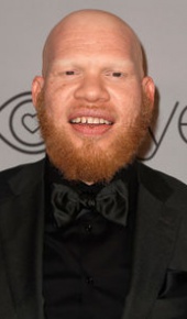 herec Marvin "Krondon" Jones III